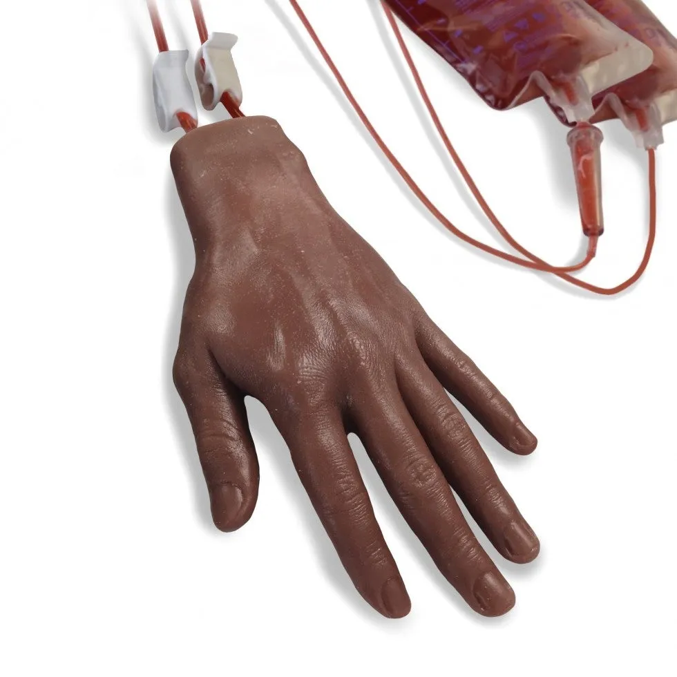 Intravenous Hand (IV)